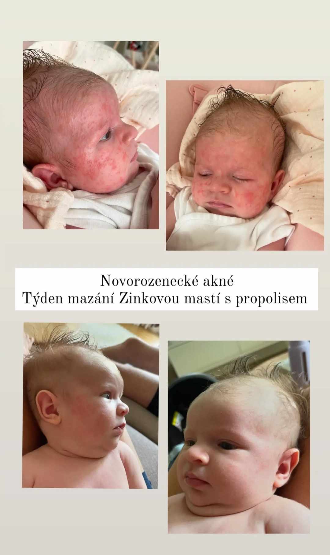 Medarek před a po